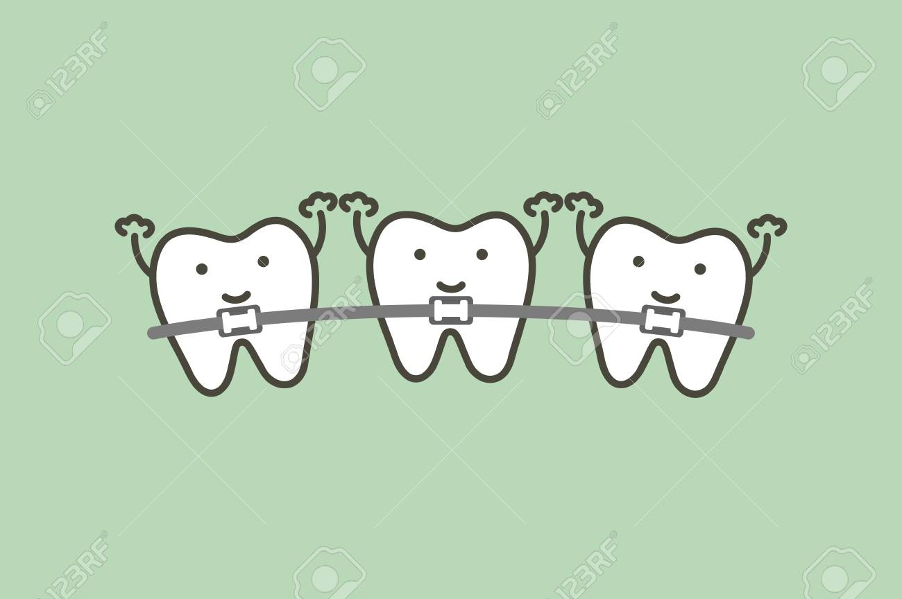 Braces